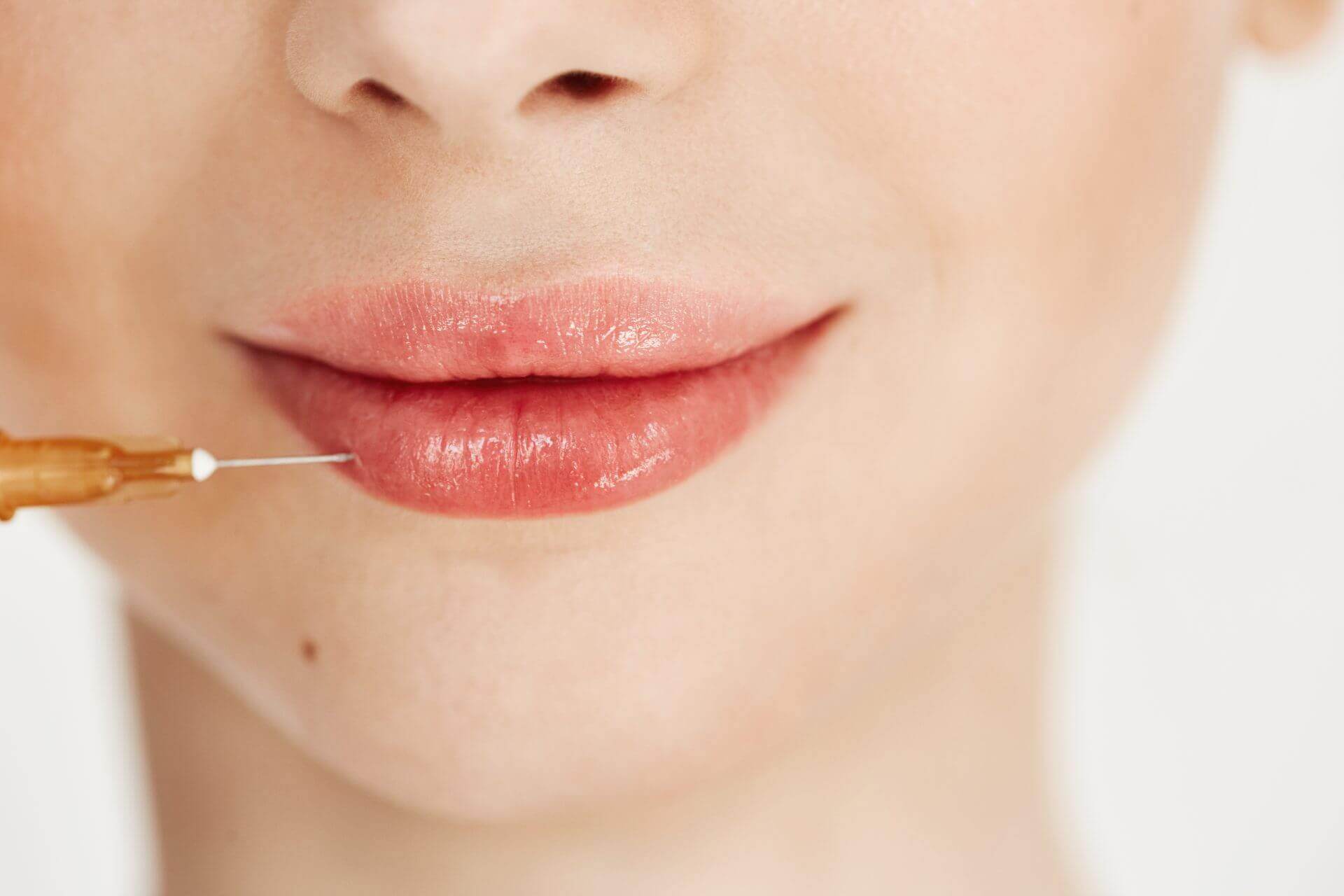 Lip Filler
